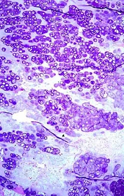 Mtd 2026 MCQs: Board Review Questions & Answers (Part 2) - Figure 133