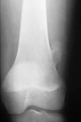 Mtd 2026 MCQs: Board Review Questions & Answers (Part 2) - Figure 135