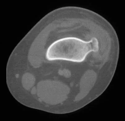 Mtd 2026 MCQs: Board Review Questions & Answers (Part 2) - Figure 139