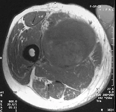 Mtd 2026 MCQs: Board Review Questions & Answers (Part 2) - Figure 161