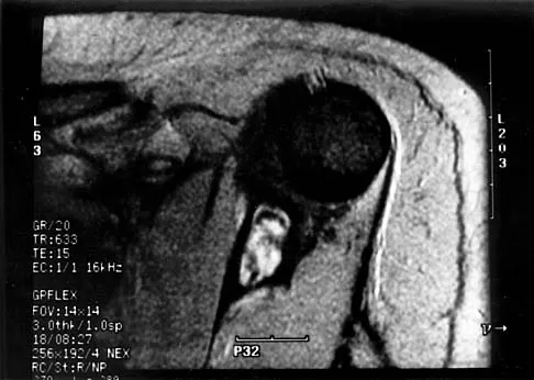 Mtd 2026 MCQs: Board Review Questions & Answers (Part 2) - Figure 187
