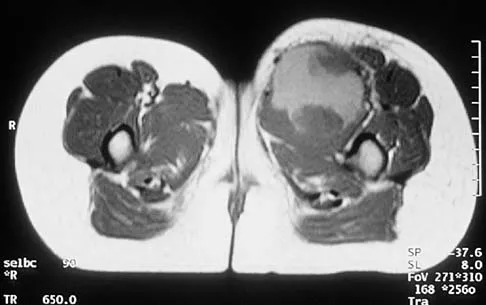 Mtd 2026 MCQs: Board Review Questions & Answers (Part 2) - Figure 201