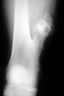 Mtd 2026 MCQs: Board Review Questions & Answers (Part 2) - Figure 207