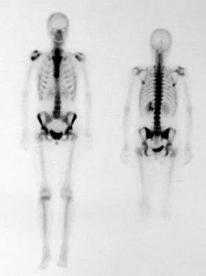 Mtd 2026 MCQs: Board Review Questions & Answers (Part 2) - Figure 225