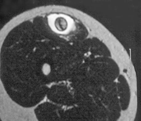 Mtd 2026 MCQs: Board Review Questions & Answers (Part 2) - Figure 229