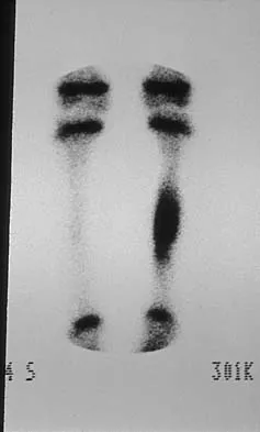 Mtd 2026 MCQs: Board Review Questions & Answers (Part 2) - Figure 23