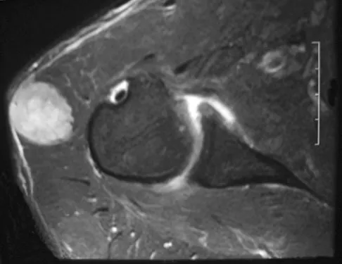 Mtd 2026 MCQs: Board Review Questions & Answers (Part 2) - Figure 239
