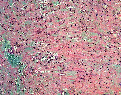 Mtd 2026 MCQs: Board Review Questions & Answers (Part 2) - Figure 241