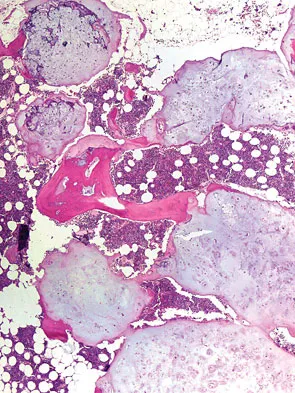 Mtd 2026 MCQs: Board Review Questions & Answers (Part 2) - Figure 253