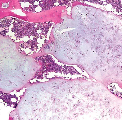Mtd 2026 MCQs: Board Review Questions & Answers (Part 2) - Figure 255