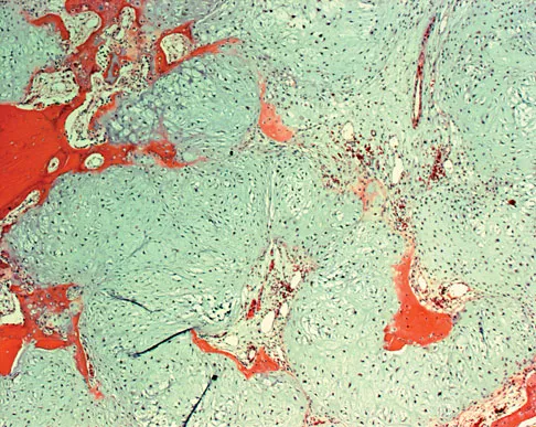 Mtd 2026 MCQs: Board Review Questions & Answers (Part 2) - Figure 265