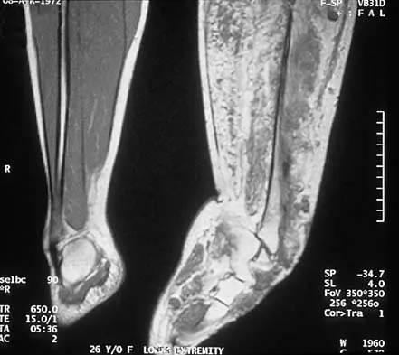 Mtd 2026 MCQs: Board Review Questions & Answers (Part 2) - Figure 43