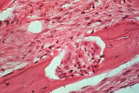 Mtd 2026 MCQs: Board Review Questions & Answers (Part 2) - Figure 5