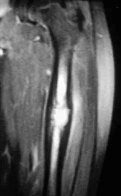 Mtd 2026 MCQs: Board Review Questions & Answers (Part 2) - Figure 75