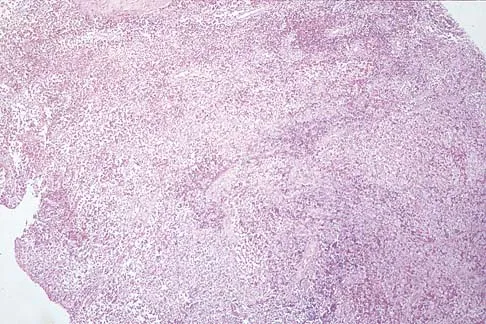 Mtd 2026 MCQs: Board Review Questions & Answers (Part 2) - Figure 77