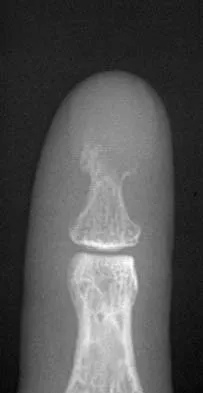 Mtd 2026 MCQs: Board Review Questions & Answers (Part 3) - Figure 101