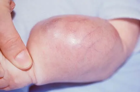 Mtd 2026 MCQs: Board Review Questions & Answers (Part 3) - Figure 105