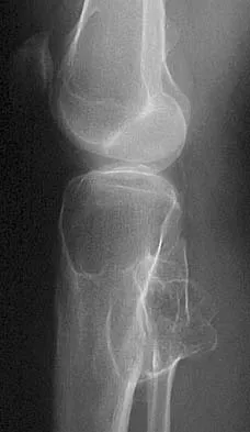 Mtd 2026 MCQs: Board Review Questions & Answers (Part 3) - Figure 115