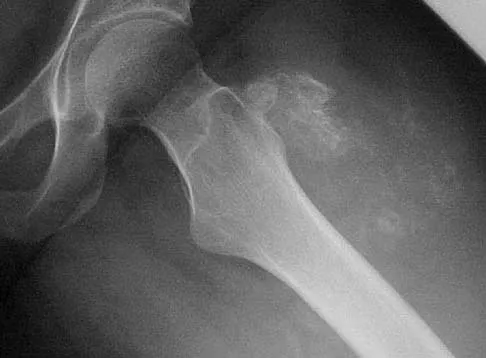 Mtd 2026 MCQs: Board Review Questions & Answers (Part 3) - Figure 117