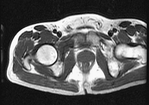 Mtd 2026 MCQs: Board Review Questions & Answers (Part 3) - Figure 127