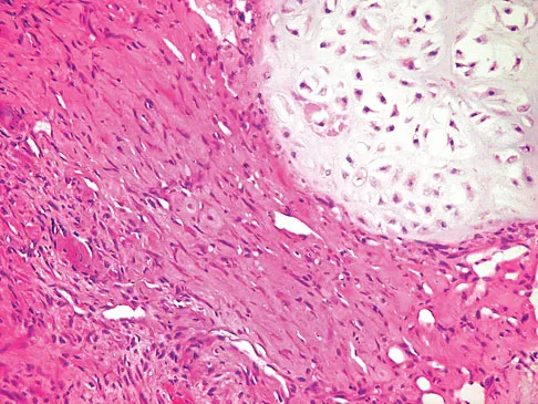 Mtd 2026 MCQs: Board Review Questions & Answers (Part 3) - Figure 131