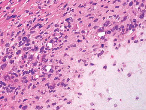 Mtd 2026 MCQs: Board Review Questions & Answers (Part 3) - Figure 133