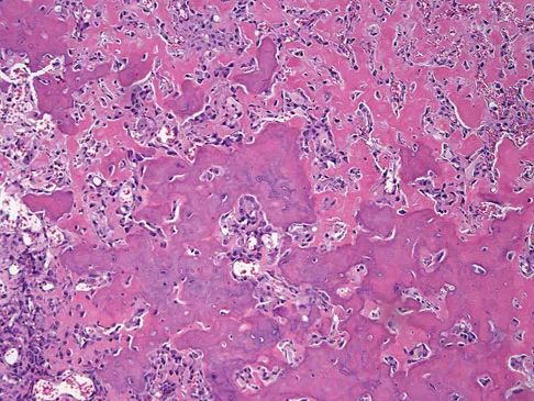 Mtd 2026 MCQs: Board Review Questions & Answers (Part 3) - Figure 161