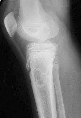 Mtd 2026 MCQs: Board Review Questions & Answers (Part 3) - Figure 165