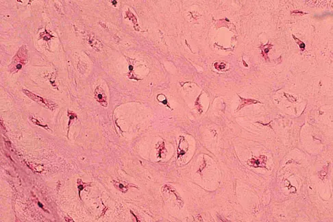 Mtd 2026 MCQs: Board Review Questions & Answers (Part 3) - Figure 171