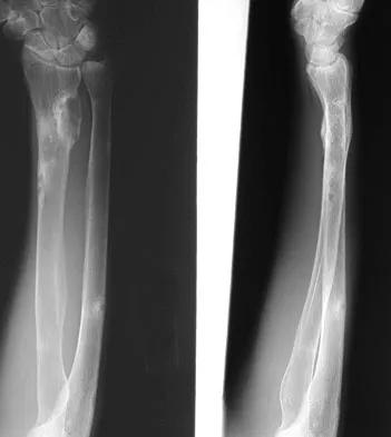 Mtd 2026 MCQs: Board Review Questions & Answers (Part 3) - Figure 177