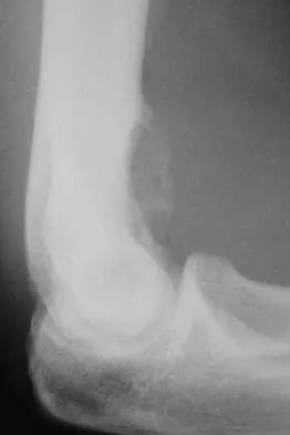 Mtd 2026 MCQs: Board Review Questions & Answers (Part 3) - Figure 181