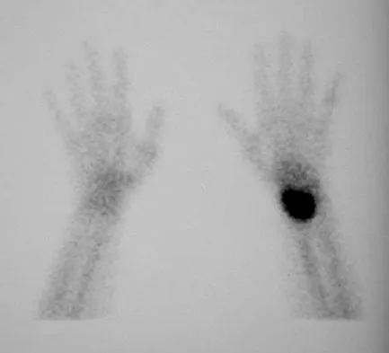 Mtd 2026 MCQs: Board Review Questions & Answers (Part 3) - Figure 199