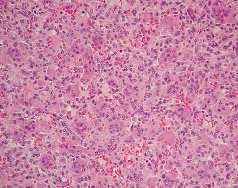 Mtd 2026 MCQs: Board Review Questions & Answers (Part 3) - Figure 203