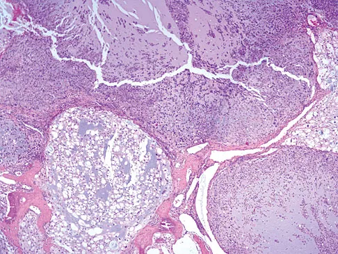 Mtd 2026 MCQs: Board Review Questions & Answers (Part 3) - Figure 205