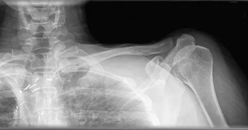 Mtd 2026 MCQs: Board Review Questions & Answers (Part 3) - Figure 219