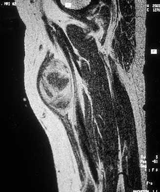 Mtd 2026 MCQs: Board Review Questions & Answers (Part 3) - Figure 23