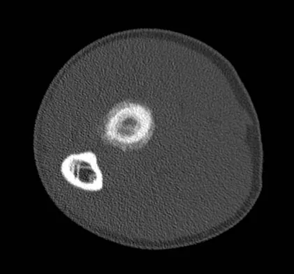 Mtd 2026 MCQs: Board Review Questions & Answers (Part 3) - Figure 243