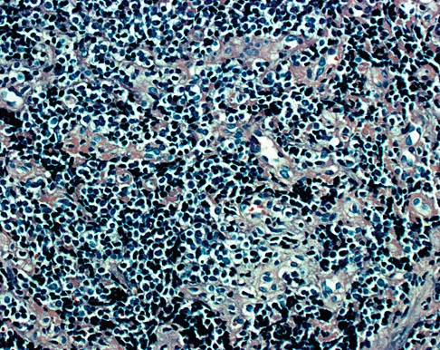 Mtd 2026 MCQs: Board Review Questions & Answers (Part 3) - Figure 249