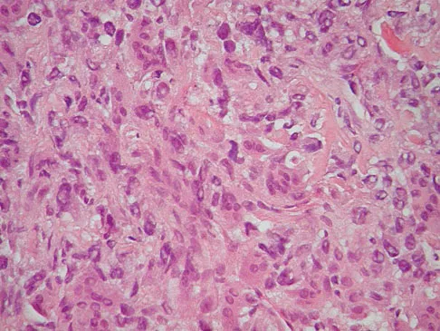 Mtd 2026 MCQs: Board Review Questions & Answers (Part 3) - Figure 263