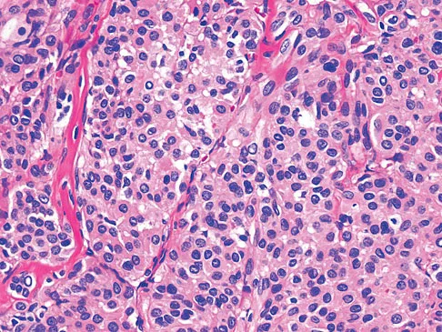 Mtd 2026 MCQs: Board Review Questions & Answers (Part 3) - Figure 265