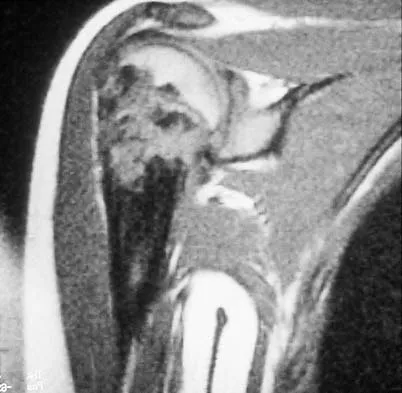 Mtd 2026 MCQs: Board Review Questions & Answers (Part 3) - Figure 29