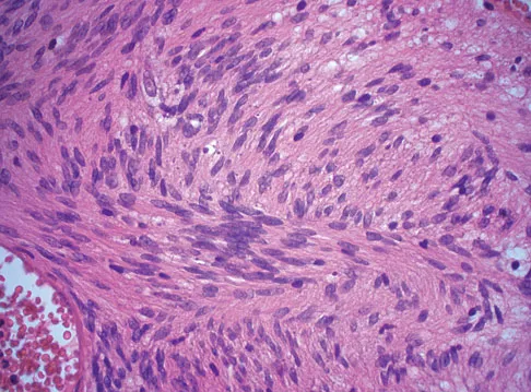 Mtd 2026 MCQs: Board Review Questions & Answers (Part 3) - Figure 301