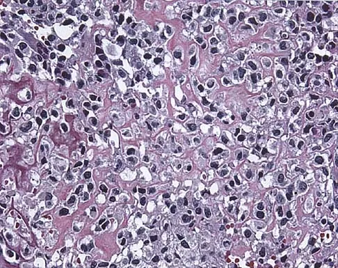 Mtd 2026 MCQs: Board Review Questions & Answers (Part 3) - Figure 33