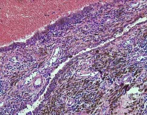 Mtd 2026 MCQs: Board Review Questions & Answers (Part 3) - Figure 55