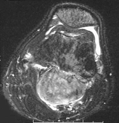 Mtd 2026 MCQs: Board Review Questions & Answers (Part 3) - Figure 65