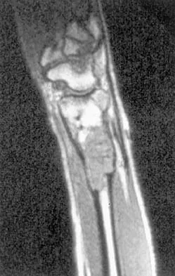 Mtd 2026 MCQs: Board Review Questions & Answers (Part 3) - Figure 7