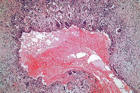 Mtd 2026 MCQs: Board Review Questions & Answers (Part 3) - Figure 73