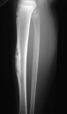 Mtd 2026 MCQs: Board Review Questions & Answers (Part 3) - Figure 77