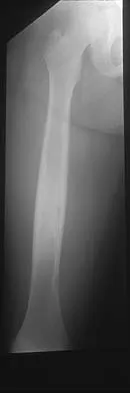 Mtd 2026 MCQs: Board Review Questions & Answers (Part 3) - Figure 83