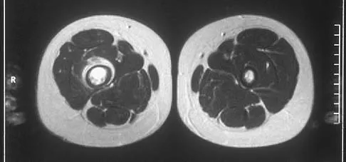 Mtd 2026 MCQs: Board Review Questions & Answers (Part 3) - Figure 87